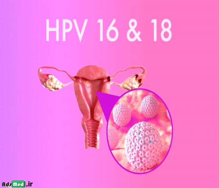 HPV همه چیز درباره انواع پر خطر و کم خطر ویروس HPV   